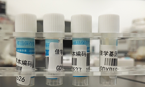 【佳學(xué)基因檢測(cè)】做Bosch-Boonstra-Schaaf視神經(jīng)萎縮綜合征基因解碼、<a href=http://m.alivewithwords.com/tk/jiema/cexujishu/2021/31933.html>基因檢測(cè)</a>需要多長(zhǎng)時(shí)間？