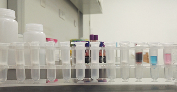 【佳學(xué)基因檢測】Brown-Vialetto-VanLaere綜合征2型基因解碼、<a href=http://m.alivewithwords.com/tk/jiema/cexujishu/2021/31933.html>基因檢測</a>報(bào)告看得懂嗎？