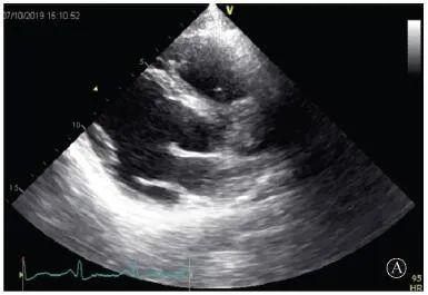 協和疑難︱第67例：臨床表現胸痛伴肌酸激酶升高