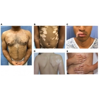 【佳學(xué)基因檢測(cè)