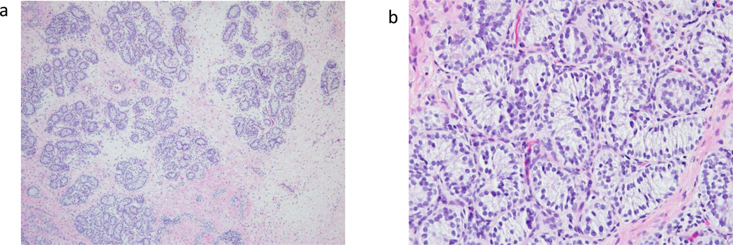 知道TSPO的這些內(nèi)容，是基因評估分析全面性一個準(zhǔn)備